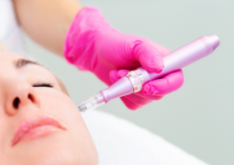 The Benefits of Microneedle: How This Procedure Can Improve Your Skin in 2023